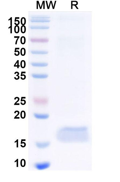 Anti-Human CD89/FCAR1 Recombinant Nanobody (SAA2151) - SDS-PAGE