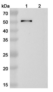 Anti-Toxoplasma gondii SAG1/Major surface antigen p30 Recombinant Monoclonal Antibody (SAA2154) - WB