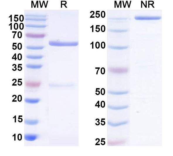 Anti-Human WNT2 Recombinant Monoclonal Antibody (SAA2156) - SDS-PAGE