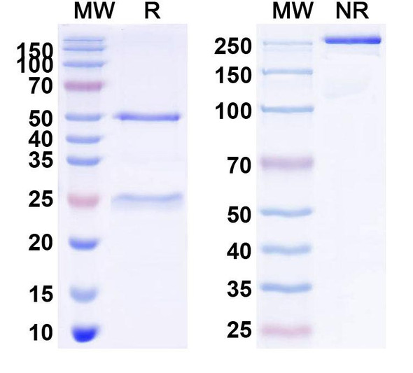 Anti-SARS-CoV-2 NP/Nucleoprotein Recombinant Monoclonal Antibody (SAA2159) - SDS-PAGE