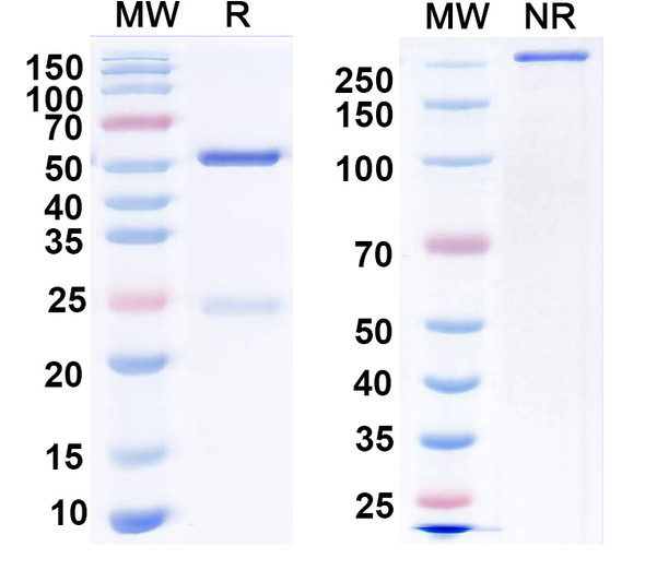 Anti-Mycobacterium tuberculosis esxA/ESAT-6 Recombinant Monoclonal Antibody (SAA2173) - SDS-PAGE