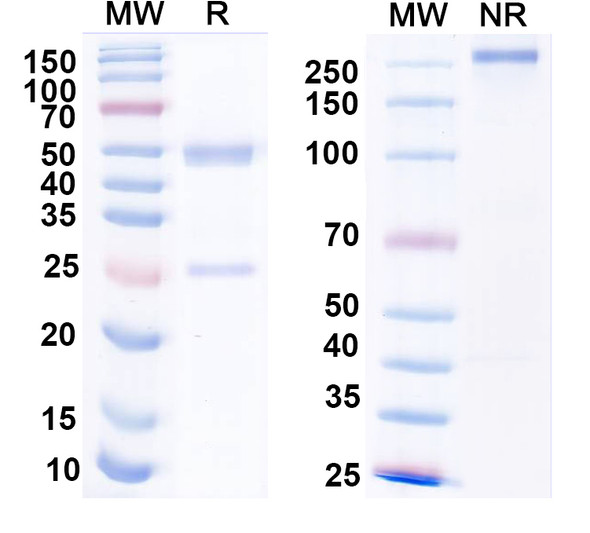 Anti-Mycobacterium tuberculosis icl1/Isocitrate lyase 1 Recombinant Monoclonal Antibody (SAA2176) - SDS-PAGE