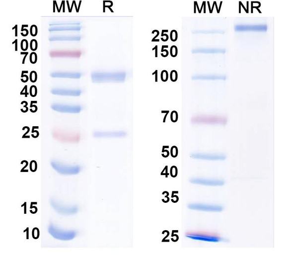 Anti-Mycobacterium tuberculosis icl1/Isocitrate lyase 1 Recombinant Monoclonal Antibody (SAA2176) - SDS-PAGE