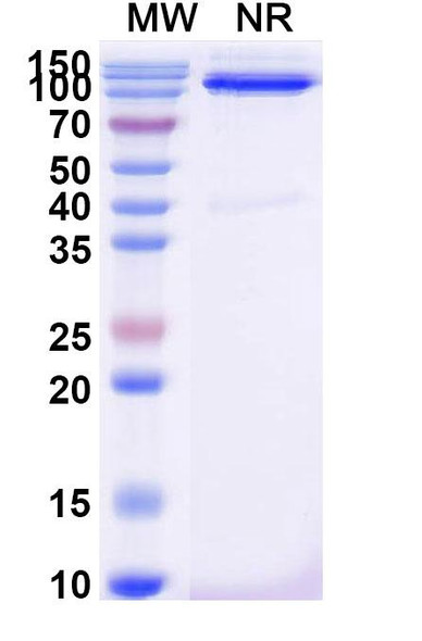 Anti-Human CD31/PECAM1 Recombinant Monoclonal Antibody (SAA2178) - SDS-PAGE