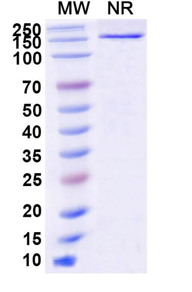 Anti-Human BRAF/B-Raf (V600E) Recombinant Monoclonal Antibody (SAA2181) - SDS-PAGE