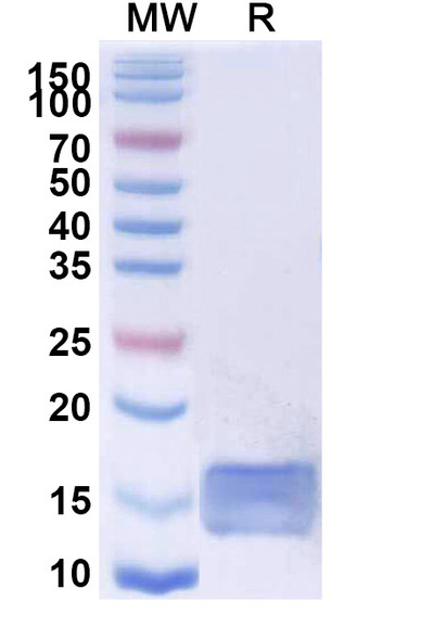 Anti-SARS-CoV-2 RBD Recombinant Nanobody (VHH-72) - SDS-PAGE