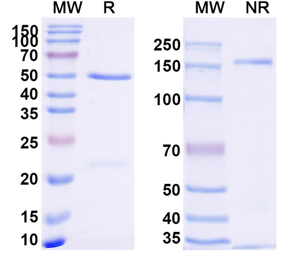 Anti-Dupilumab Non-Neutralizing Recombinant Monoclonal Antibody (SAA2185) - SDS-PAGE