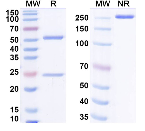 Anti-Hantaan virus/HTNV GP Recombinant Monoclonal Antibody (A5) - SDS-PAGE