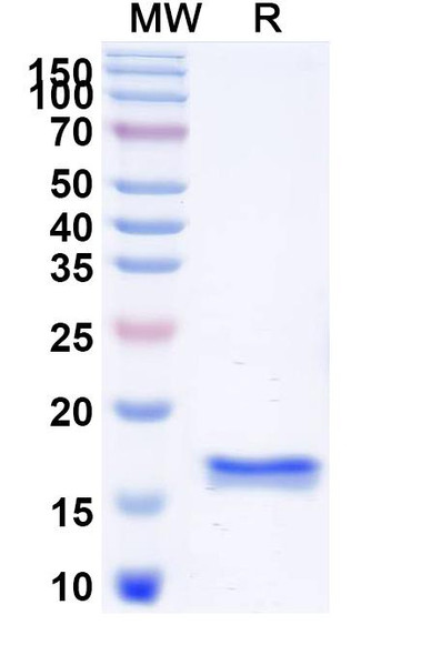 Anti-Human CD45/PTPRC Recombinant Nanobody (2H7) - SDS-PAGE