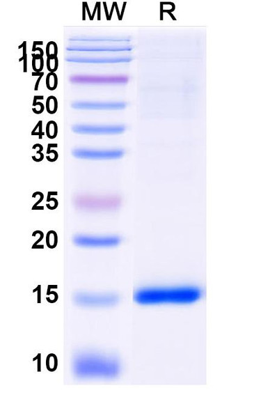 Anti-Human CASP3 Recombinant Nanobody (VHH2) - SDS-PAGE