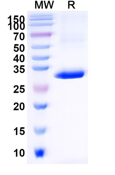 Anti-Human CD1d Recombinant Nanobody (ID12) - SDS-PAGE