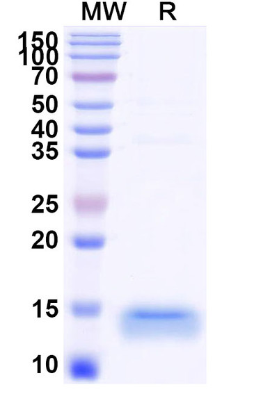 Anti-Human CD366/HAVCR2/TIM-3 Recombinant Nanobody (R53) - SDS-PAGE