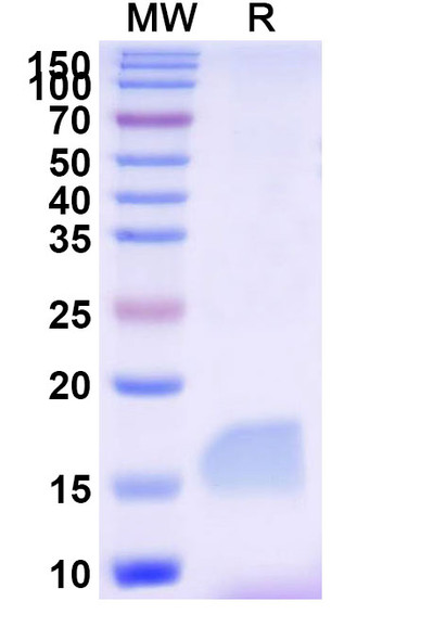 Anti-Human LAG3 Recombinant Nanobody (SAA2195) - SDS-PAGE