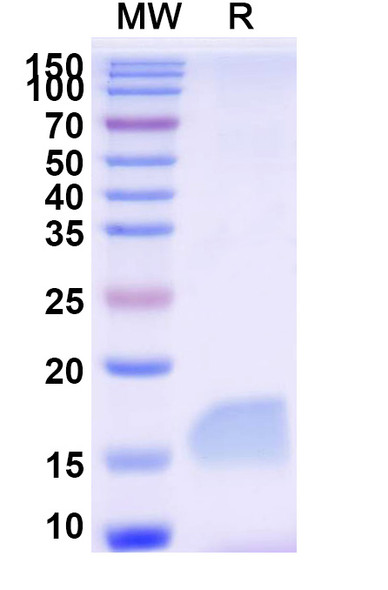 Anti-Human LAG3 Recombinant Nanobody (SAA2195) - SDS-PAGE