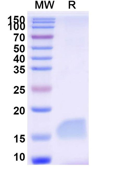 Anti-Human LAG3 Recombinant Nanobody (SAA2195) - SDS-PAGE