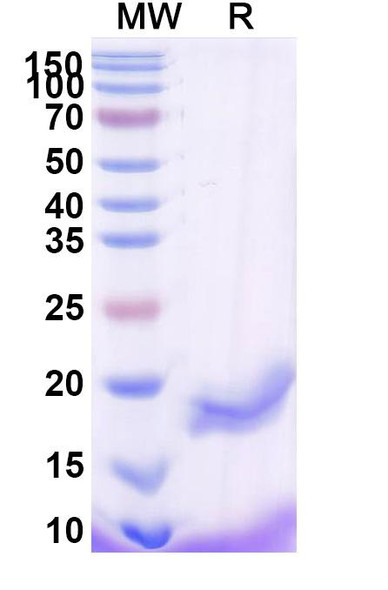 Anti-Human CD276/B7-H3 Recombinant Nanobody (SAA2193) - SDS-PAGE