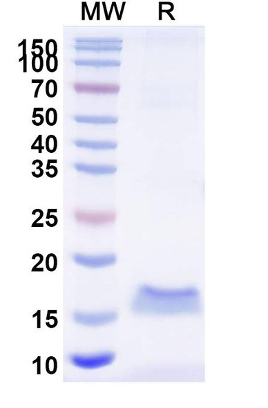 Anti-HMPV Fusion glycoprotein F0 Recombinant Nanobody (SAA2194) - SDS-PAGE