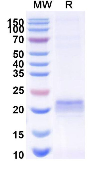 Anti-Rat ARC Recombinant Nanobody (E5#) - SDS-PAGE