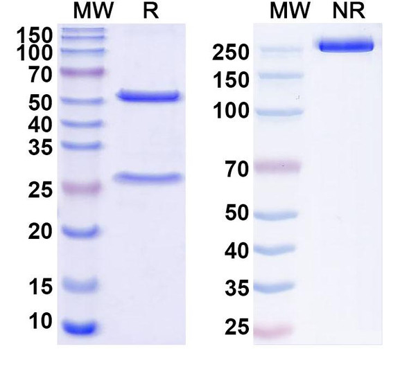 Anti-HBV preS2 domain Recombinant Monoclonal Antibody (F124) - SDS-PAGE