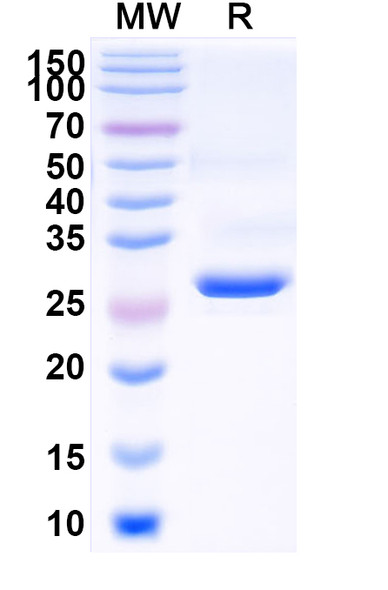 Anti-Staphylococcus aureus Alpha-toxin/hly Recombinant Monoclonal Antibody (SAA2205) - SDS-PAGE