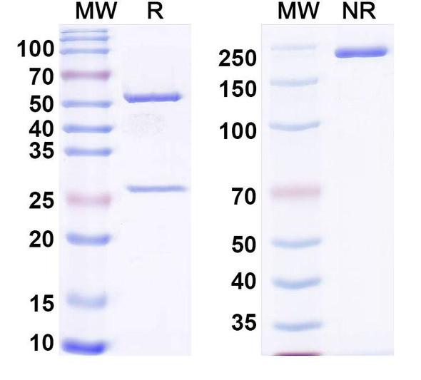 Anti-dsRNA/ssRNA Recombinant Monoclonal Antibody (P6) - SDS-PAGE