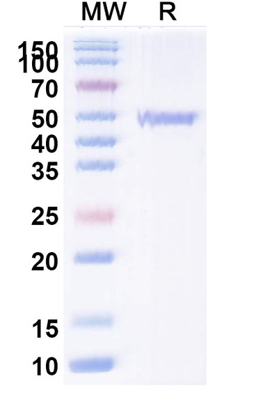 Anti-Human ATP7B Recombinant Monoclonal Antibody (2R50) - SDS-PAGE