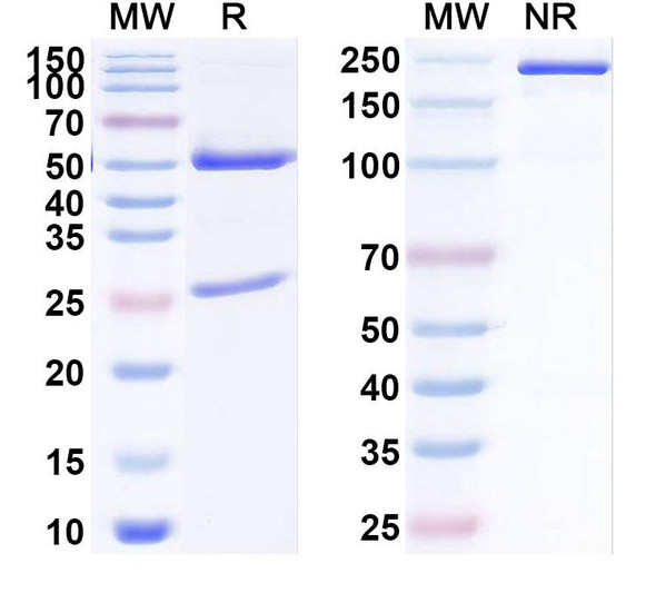 Anti-Human FALZ/BPTF IP Recombinant Monoclonal Antibody (SAA0188) - SDS-PAGE