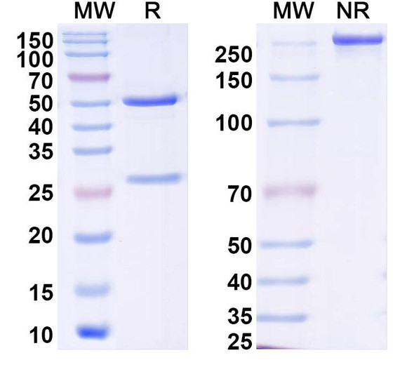 Anti-Human BRD2 IP Recombinant Monoclonal Antibody (SAA0190) - SDS-PAGE