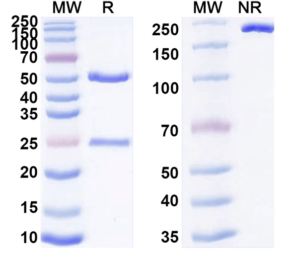 Anti-Human KDM2A IP Recombinant Monoclonal Antibody (SAA0201) - SDS-PAGE