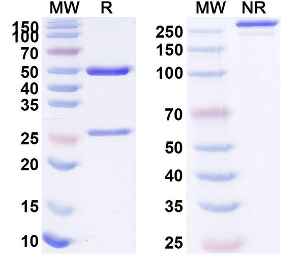 Anti-Human KDM4A IP Recombinant Monoclonal Antibody (SAA0204) - SDS-PAGE
