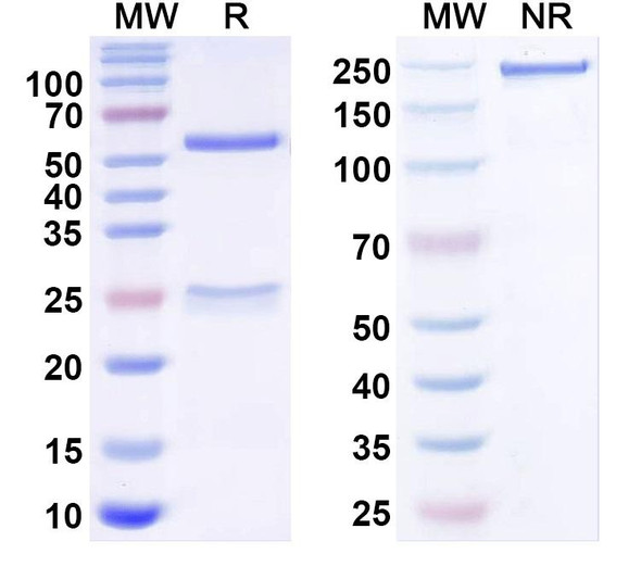 Anti-Human KDM4B IP Recombinant Monoclonal Antibody (SAA0205) - SDS-PAGE