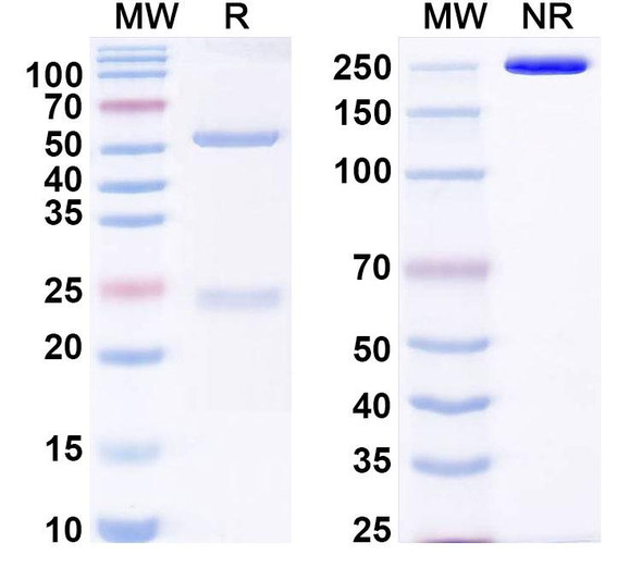 Anti-Human MEN1 IP Recombinant Monoclonal Antibody (SAA0211) - SDS-PAGE
