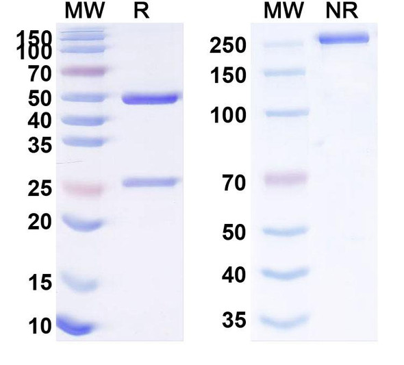 Anti-Human MSH6 IP Recombinant Monoclonal Antibody (SAA0212) - SDS-PAGE