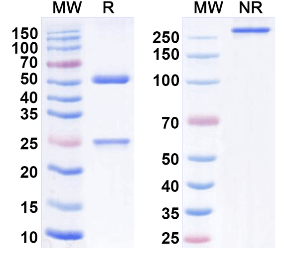 Anti-Human PBRM1 IP Recombinant Monoclonal Antibody (SAA0215) - SDS-PAGE