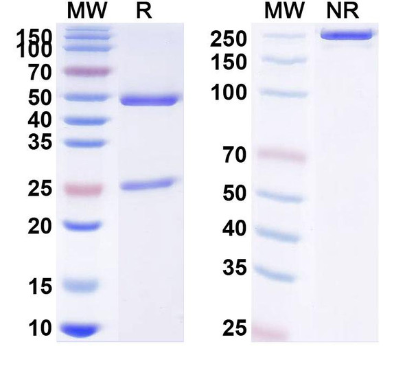 Anti-Human SETMAR IP Recombinant Monoclonal Antibody (SAA0224) - SDS-PAGE