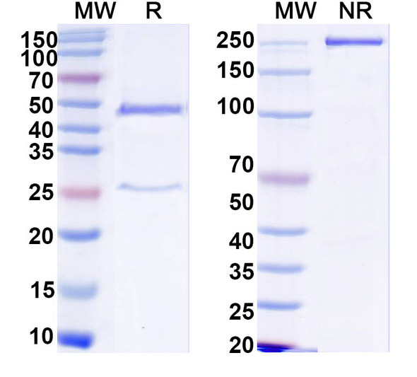 Anti-Human SFMBT1 IP Recombinant Monoclonal Antibody (SAA0225) - SDS-PAGE