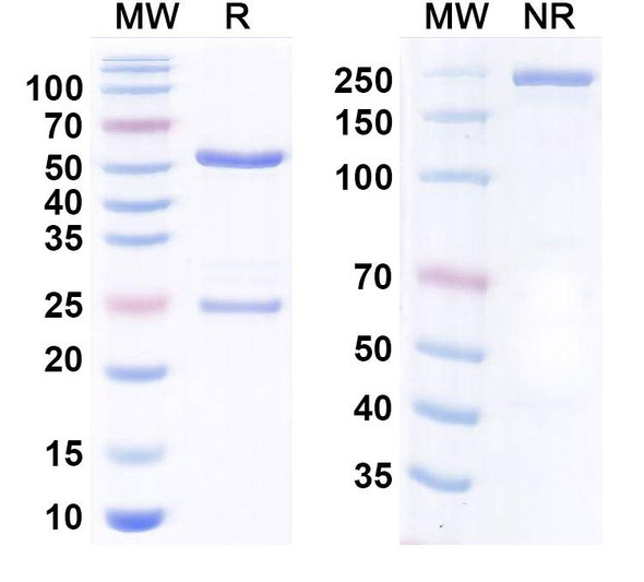 Anti-Human SIRT5 IP Recombinant Monoclonal Antibody (SAA0227) - SDS-PAGE