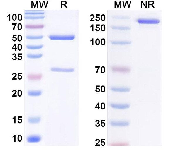 Anti-Human SKB1/PRMT5 IP Recombinant Monoclonal Antibody (SAA0228) - SDS-PAGE