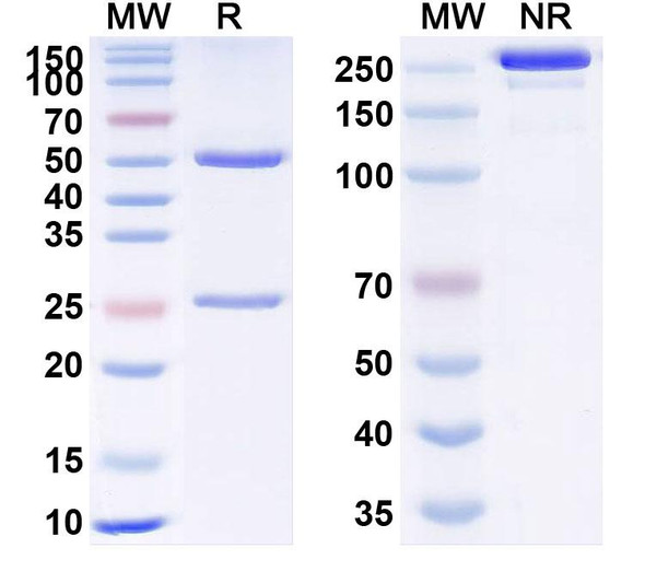 Anti-Human TBL1X IP Recombinant Monoclonal Antibody (SAA0233) - SDS-PAGE