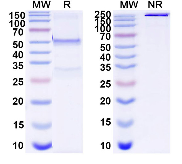 Anti-Human TSC2 IP Recombinant Monoclonal Antibody (SAA0237) - SDS-PAGE