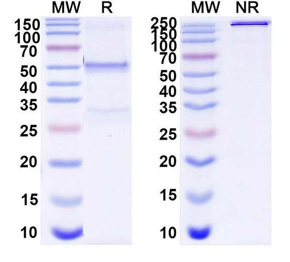 Anti-Human TSC2 IP Recombinant Monoclonal Antibody (SAA0237) - SDS-PAGE