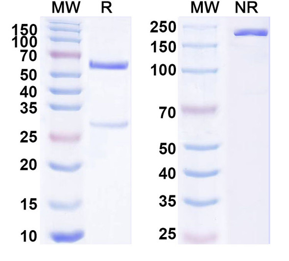 Anti-Human ZNF408 IP Recombinant Monoclonal Antibody (SAA0241) - SDS-PAGE