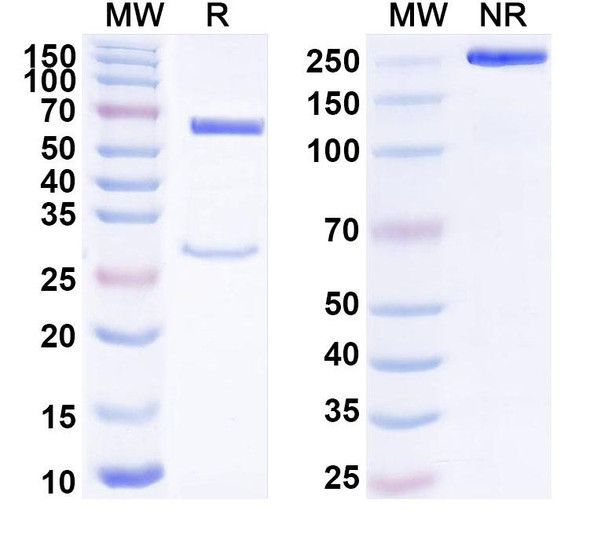 Anti-Human KDM4D IP Recombinant Monoclonal Antibody (SAA0247) - SDS-PAGE