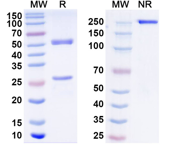 Anti-Human NSD3/WHSC1L1 IP Recombinant Monoclonal Antibody (SAA0250) - SDS-PAGE
