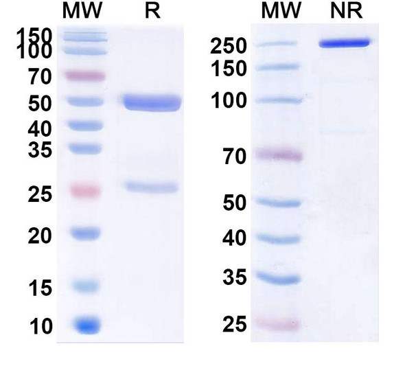 Anti-Human L3MBTL4 IP Recombinant Monoclonal Antibody (SAA0252) - SDS-PAGE
