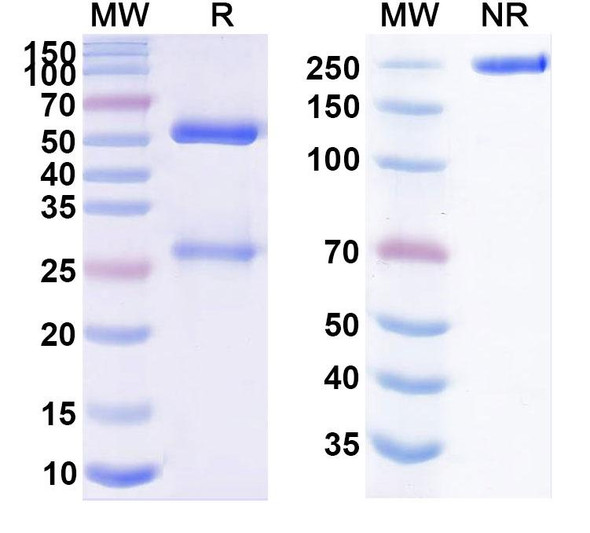 Anti-Human SMARCA2 IP Recombinant Monoclonal Antibody (SAA0257) - SDS-PAGE