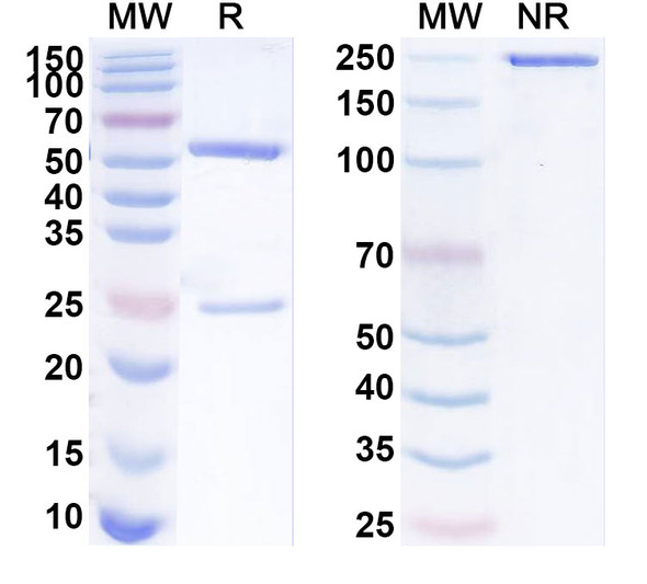Anti-Human L3MBTL1 IP Recombinant Monoclonal Antibody (SAA0263) - SDS-PAGE