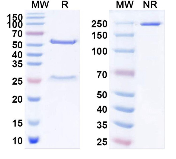 Anti-Lagovirus Capsid protein VP60 Recombinant Monoclonal Antibody (2D9) - SDS-PAGE