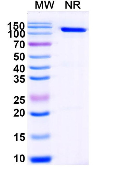 Anti-GST 26 Recombinant Nanobody (SAA1199) - SDS-PAGE