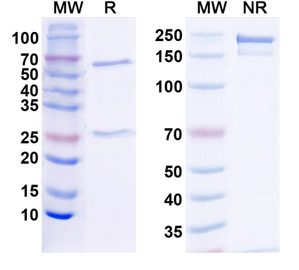 Anti-Human DST/Dystonin Recombinant Monoclonal Antibody (SAA2232) - SDS-PAGE